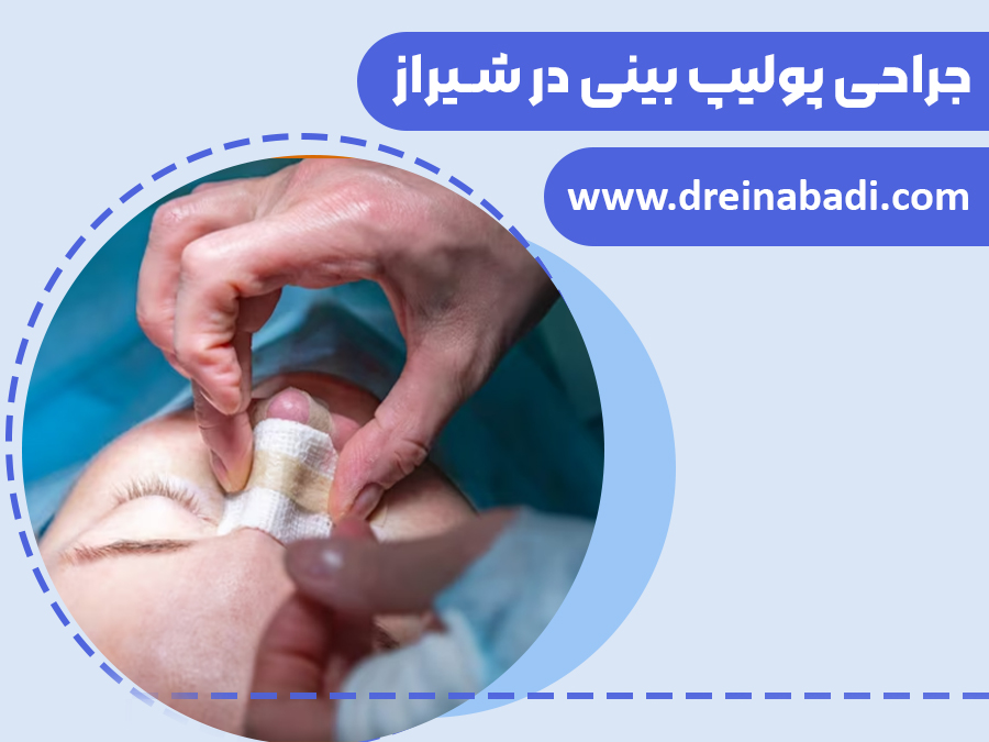 جراحیپولیپبینیدرشیراز