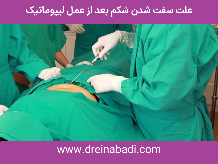 علتسفتشدنشکمبعدازعمللیپوماتیک