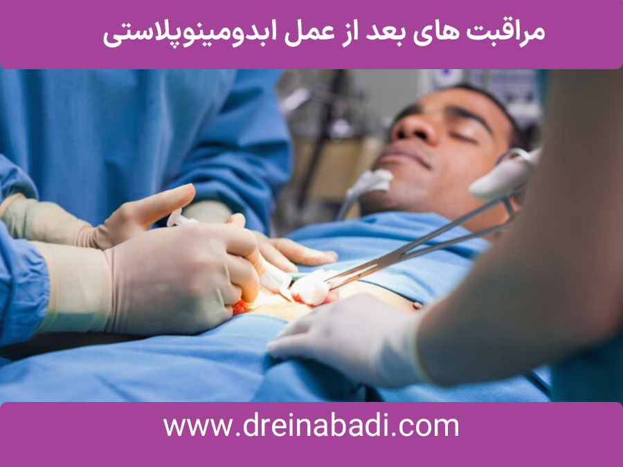 مراقبتهایبعدازعملابدومینوپلاستی
