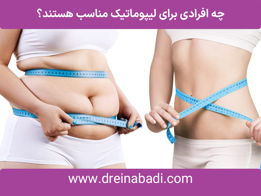 مراقبتهایقبلوبعدازعمللیپوماتیک