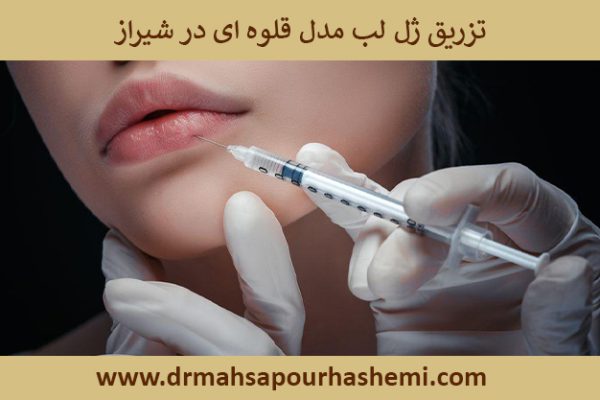 تزریقژللبمدلقلوهایدرشیراز