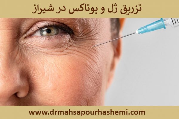 تزریقژلوبوتاکسدرشیراز