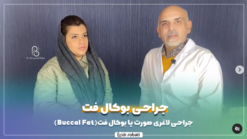 جراحیبوکالفت