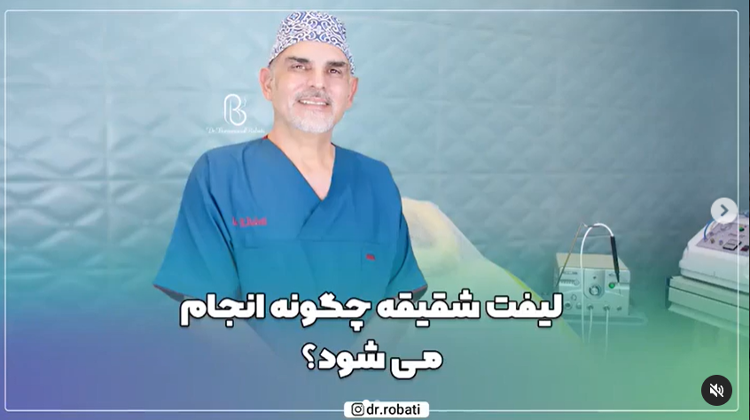 لیفتشقیقهچگونهانجاممیشود