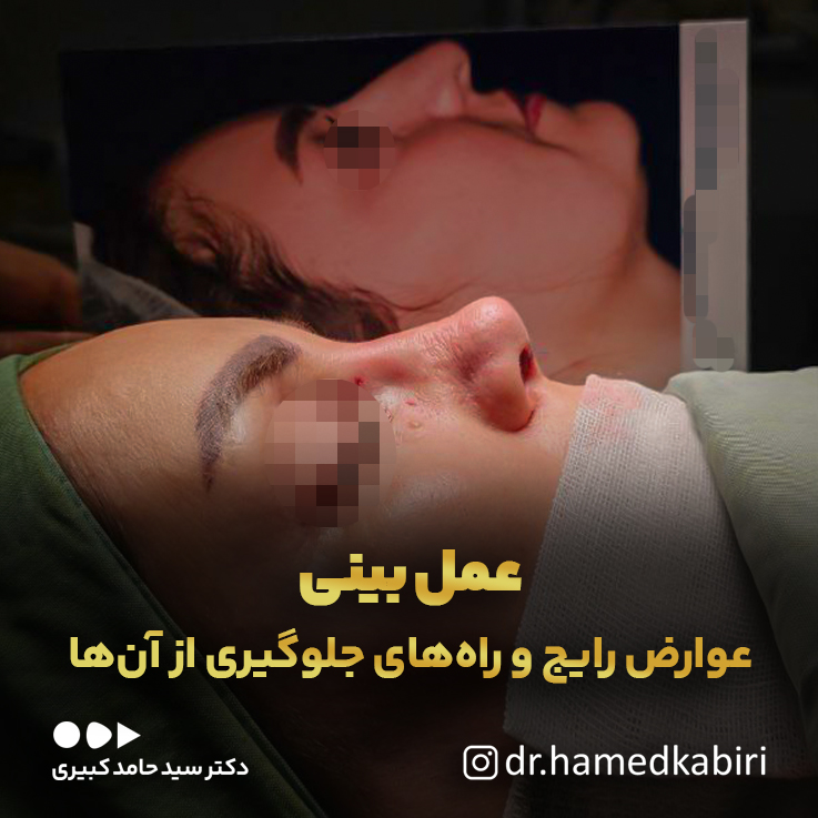 عملبینی،عوارضرایجوراههایجلوگیریازآنها