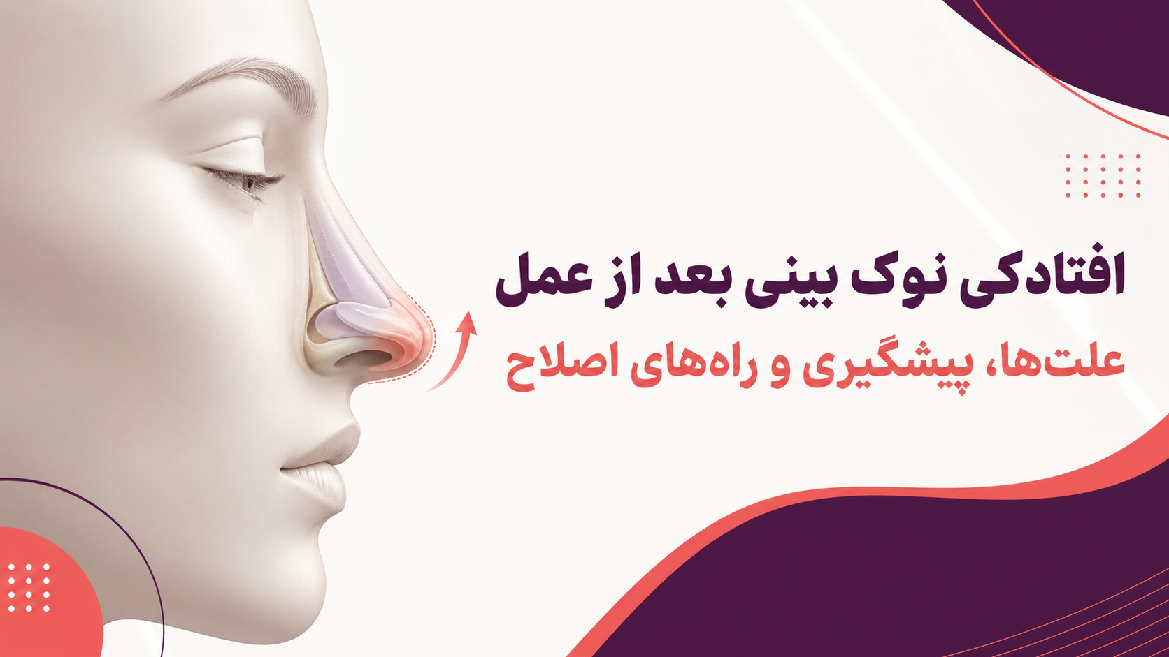 افتادگینوکبینیبعدازعمل؛علت‌ها،پیشگیریوراه‌هایاصلاح