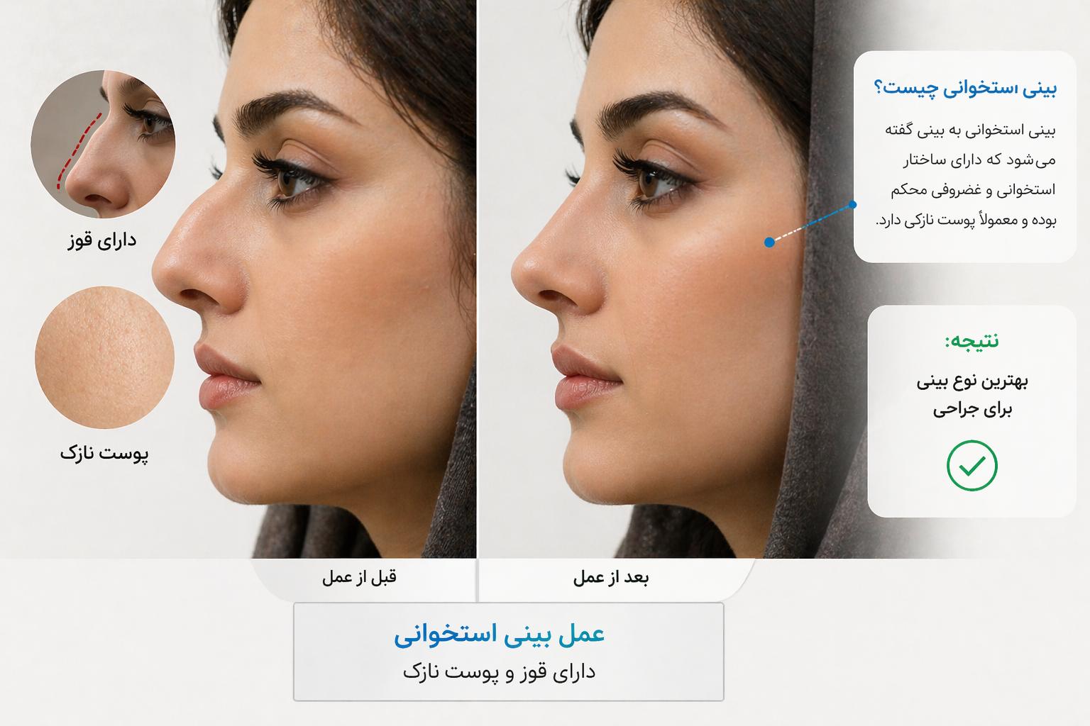 بینیاستخوانیچیست؟